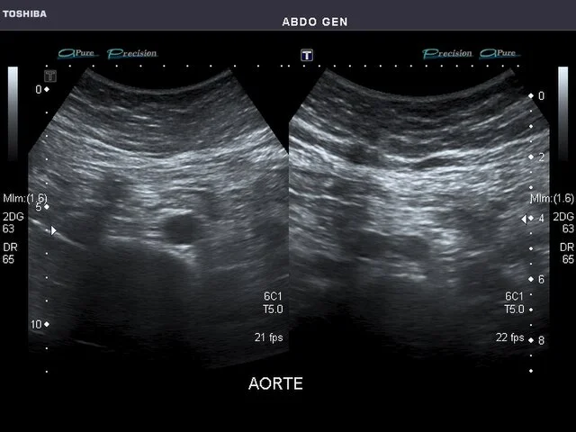 Routine ultrasound USG
