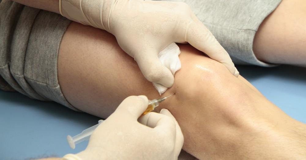 PRP therapy for joint pain